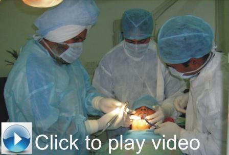 click to play live surgery of dental implants